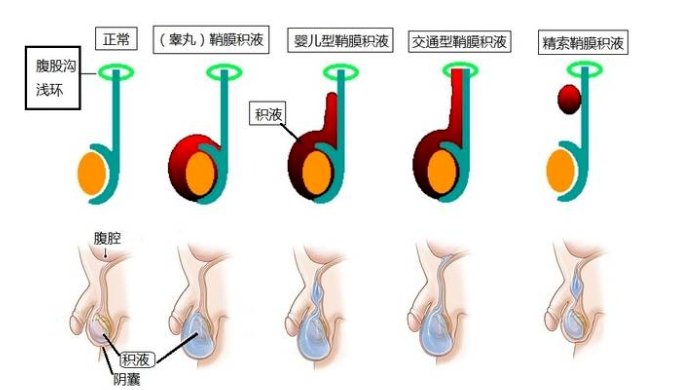 宝宝标准睾丸图片蛋蛋图片