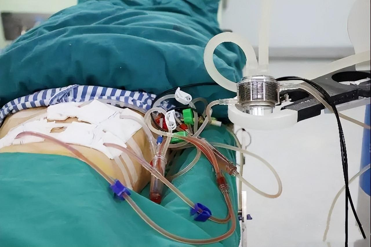 2015年北大学霸将癌晚期父亲骗出国88天后归来结局令人感动