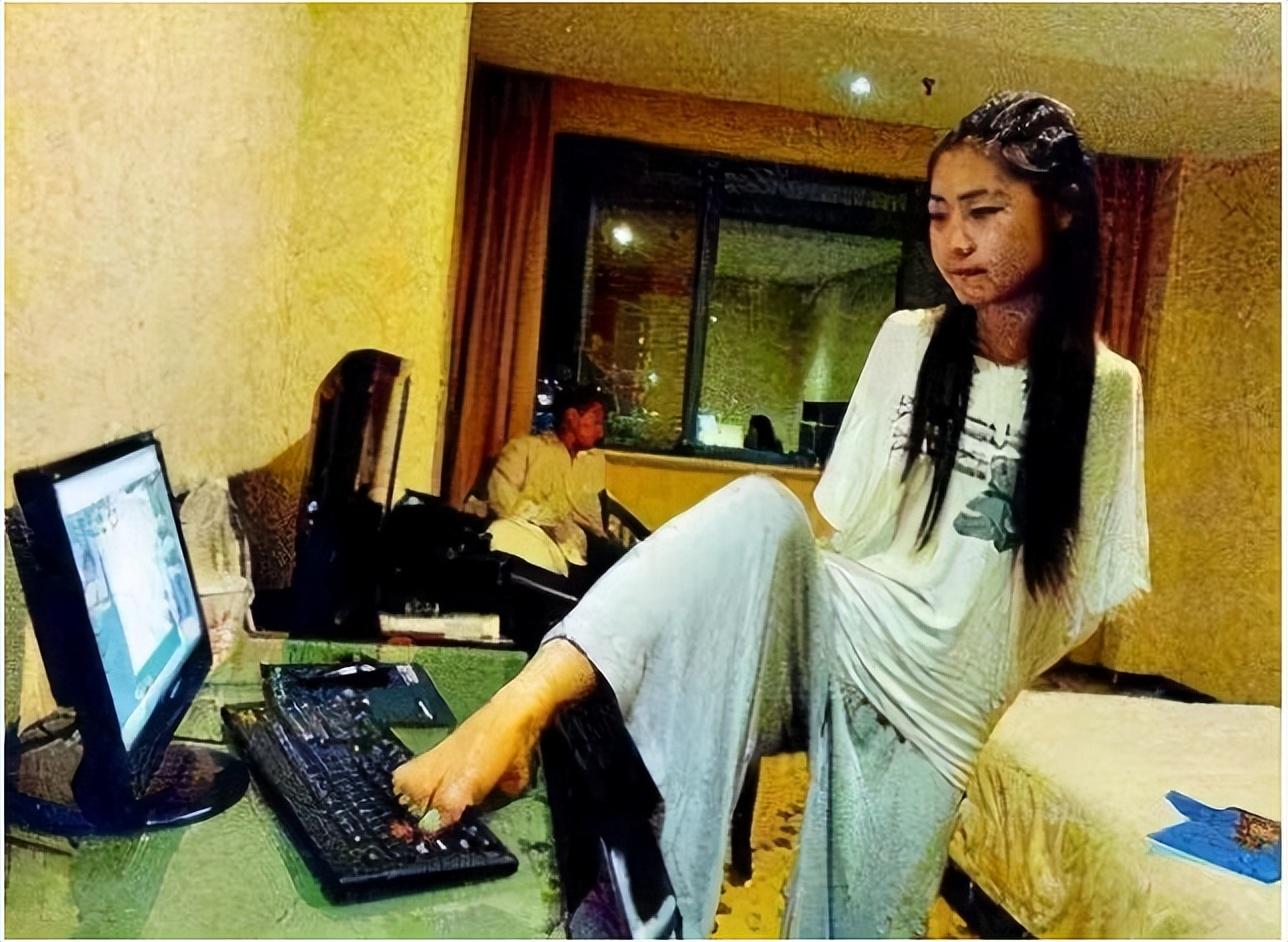 回顾折翼天使杨佩9岁失去双臂24岁创业当老板双脚活出精彩人生