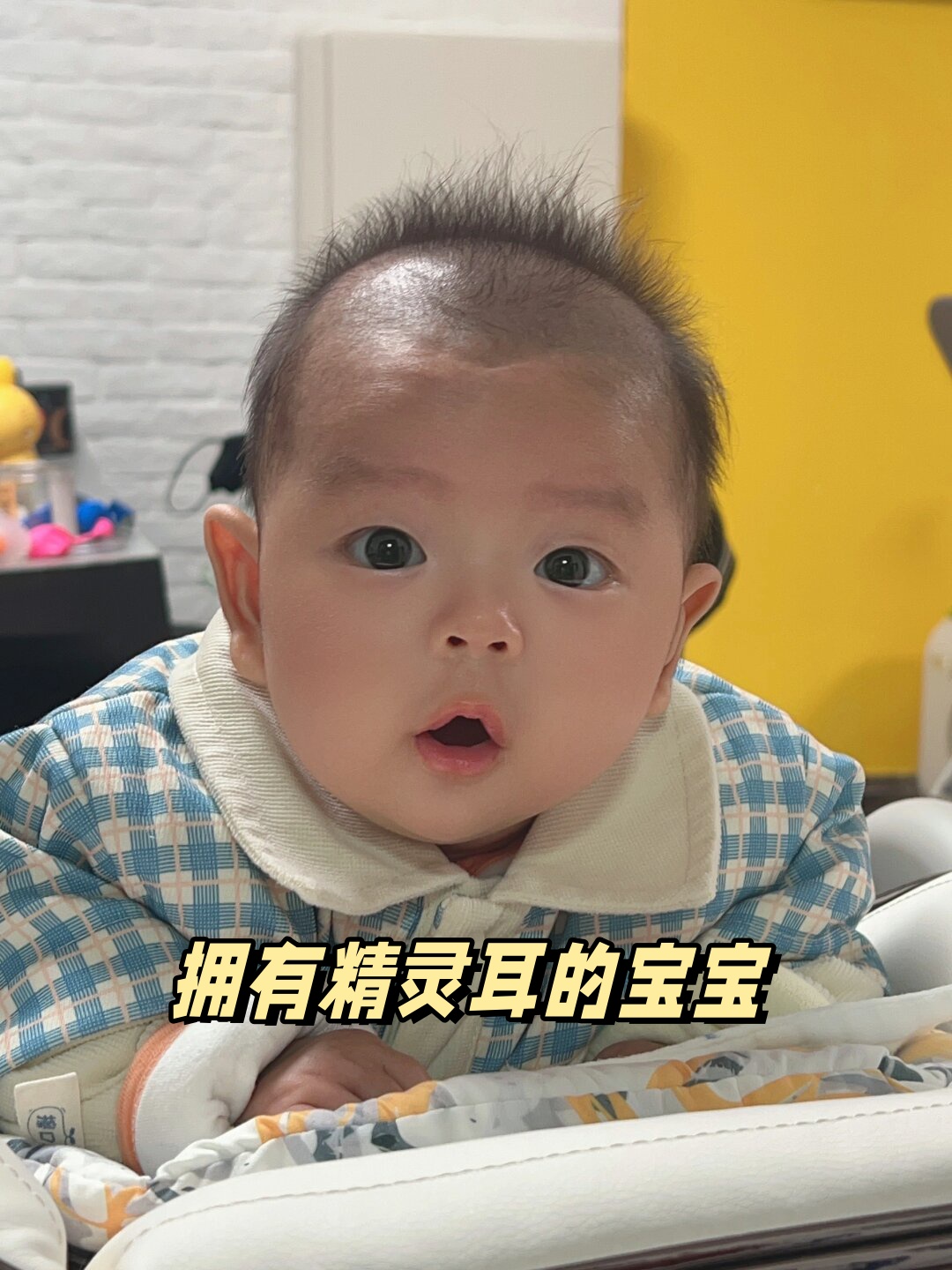 拥有精灵耳的宝宝  简直太可爱了!