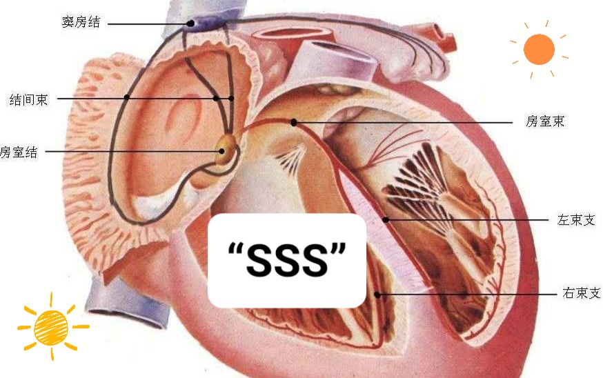「病态窦房结综合征的诊断治疗进展」解放军总医院王广义