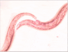 几十年前,人人肚子里几乎都有蛔虫,为何现在没有人听说过了?