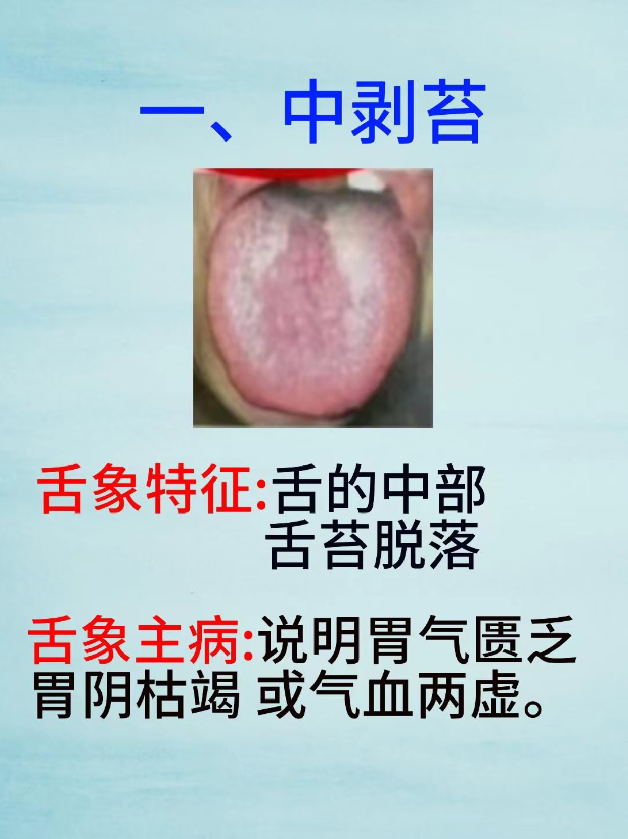 这些舌象你有吗?