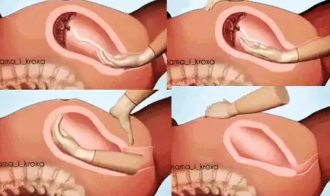 顺产生孩子有多痛 一组3d图告诉你