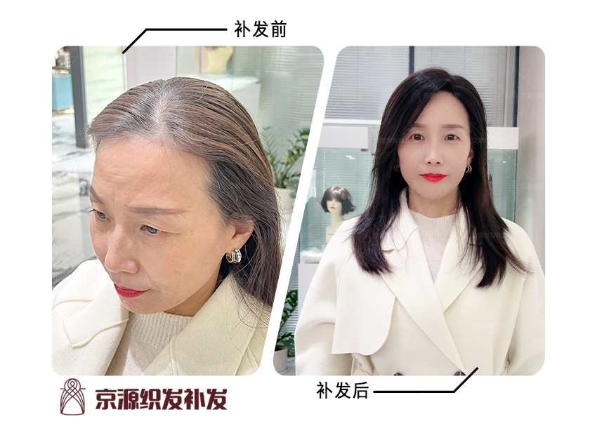 女生戴什么款式的假发好看?京源织发补发时尚款式任你挑选