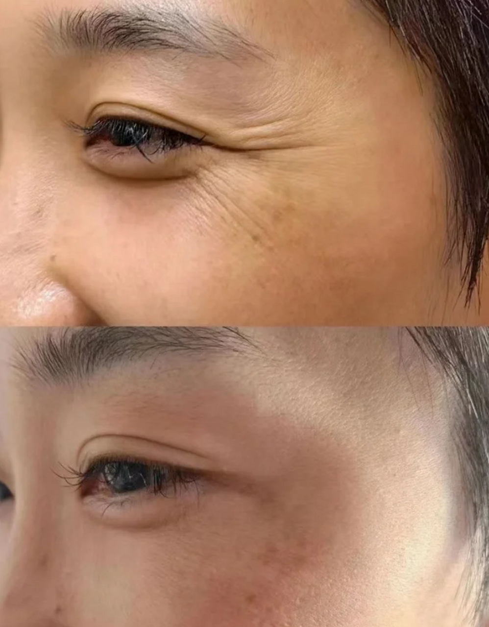 春节变美计划# 皮肤管理