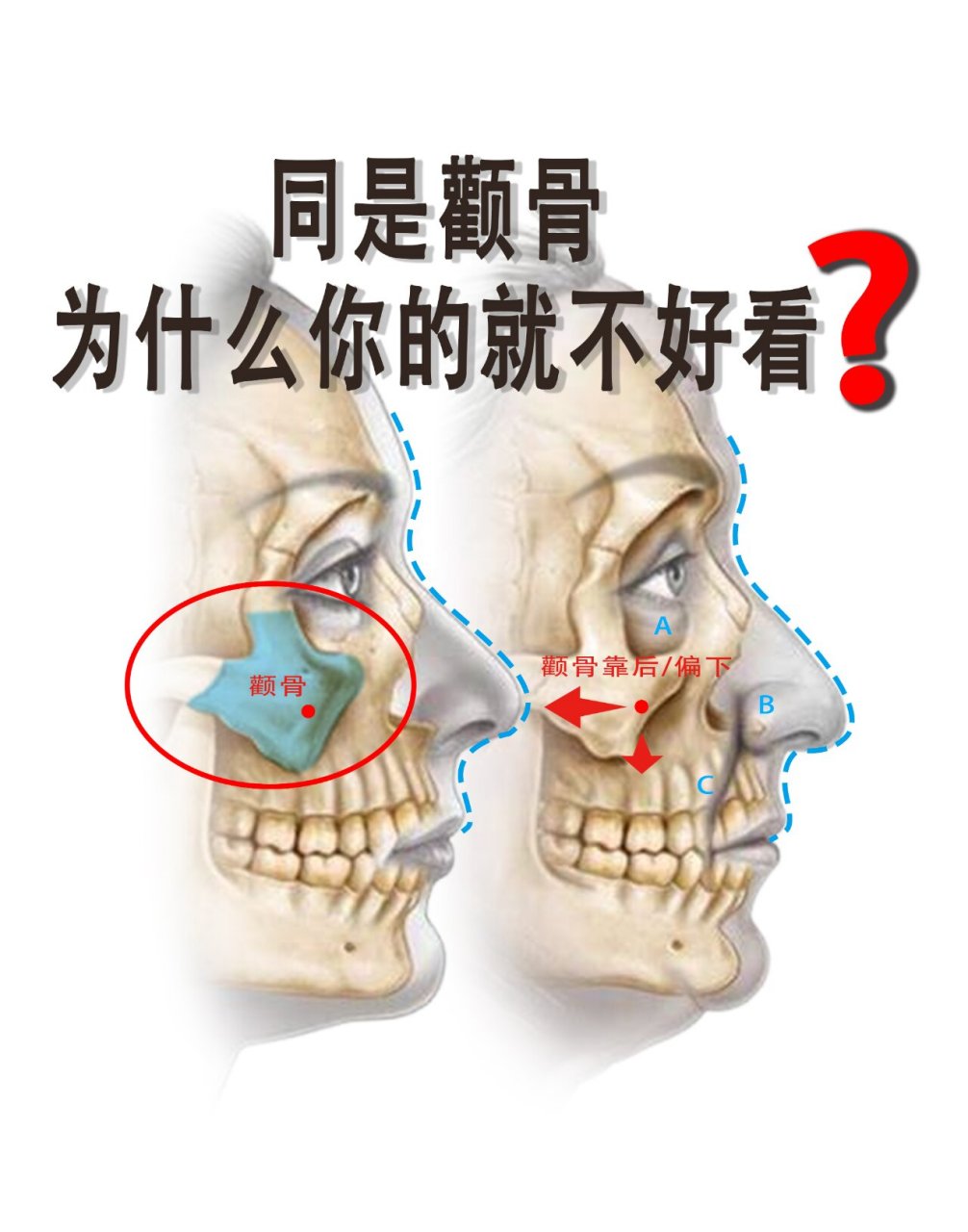 脸颊骨在什么位置图片图片