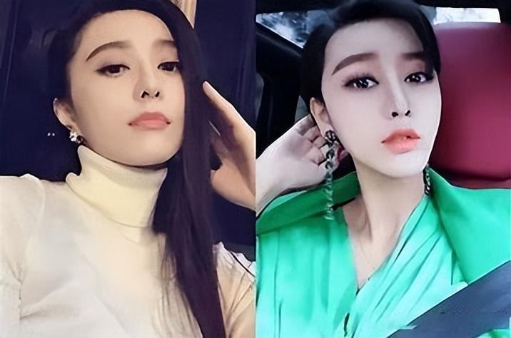 回顾深圳女网红8年花800万整成范冰冰嫁给主刀医生后来怎样了