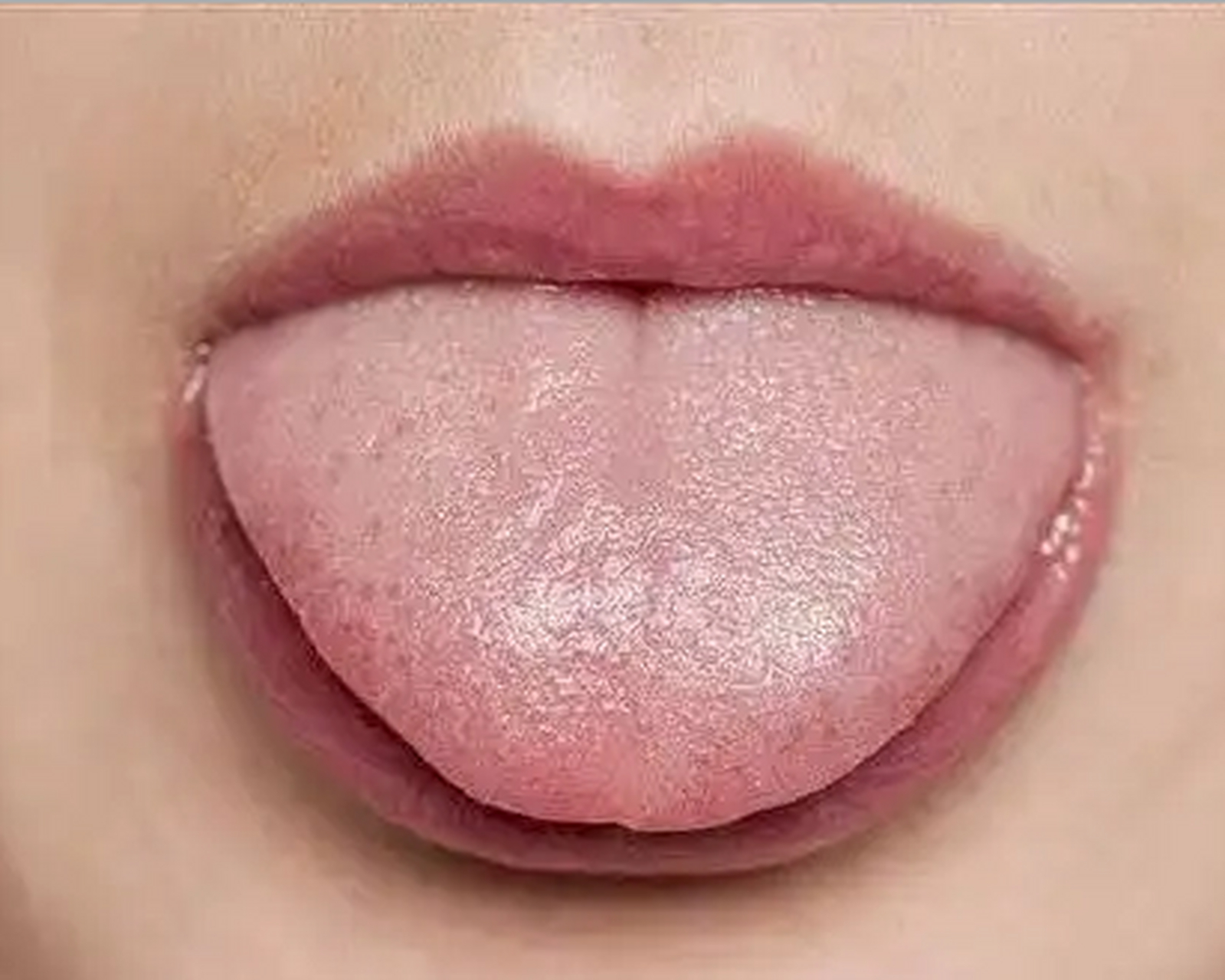 舌头像开水烫,火辣疼,10秒教你辨别,千万别治错了.