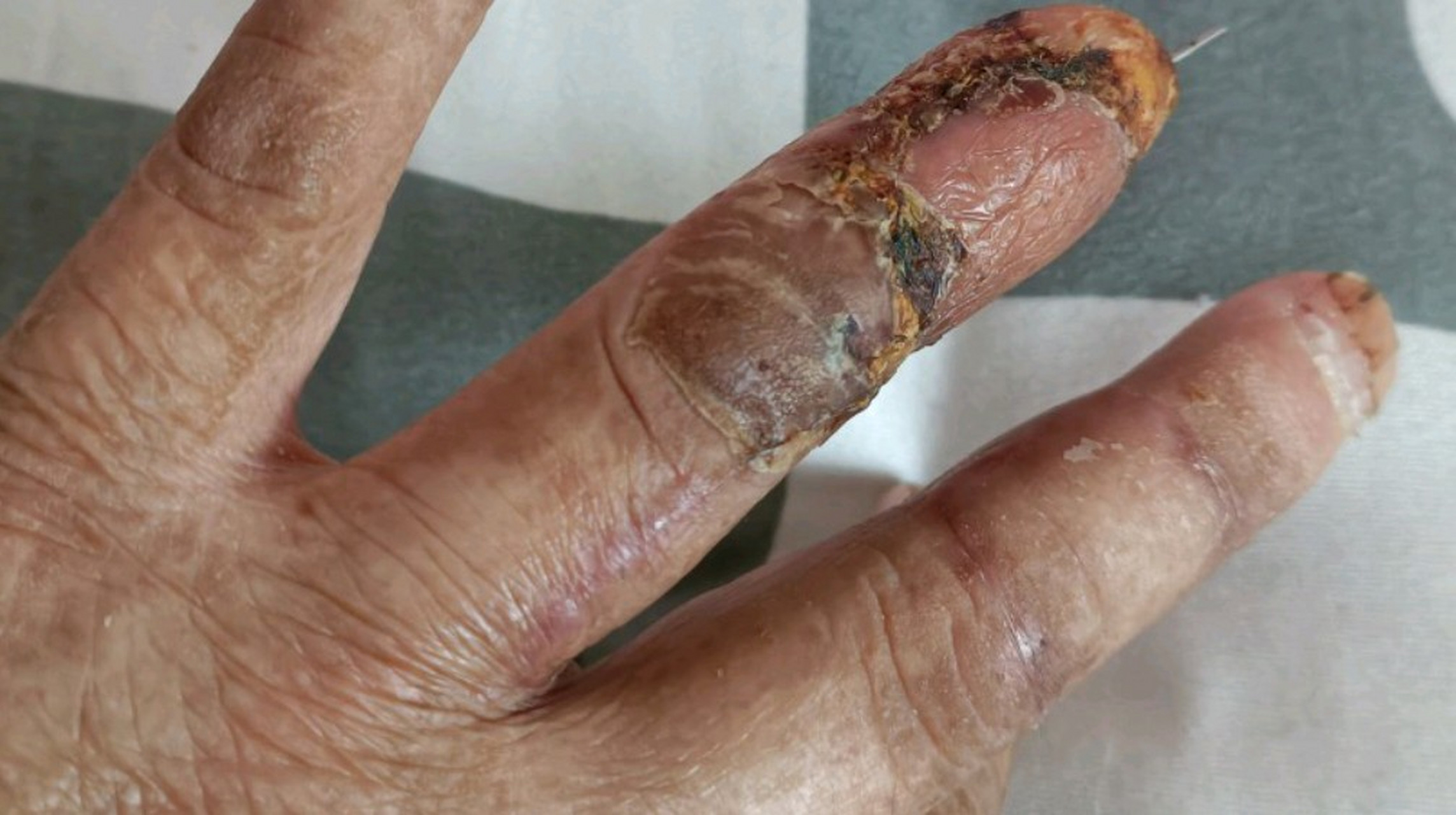 因为手指受伤已经停更几个月了,今天想发文章却发不出去,有谁能告诉我