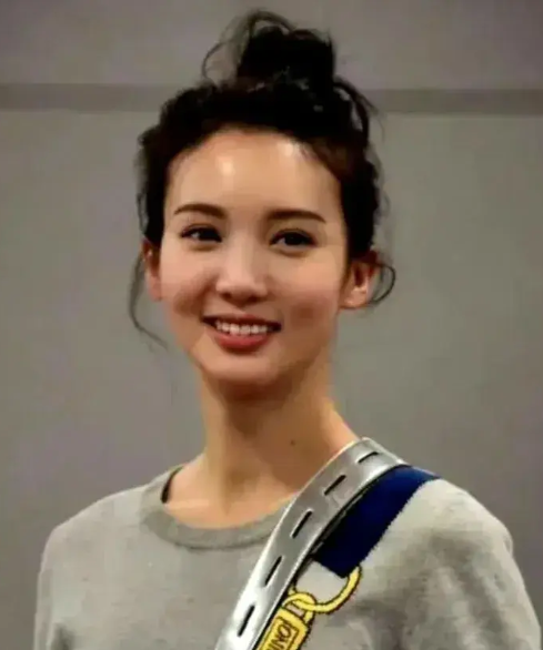 回顾减肥过度是什么样看这几位明星就知道了简直惨不忍睹