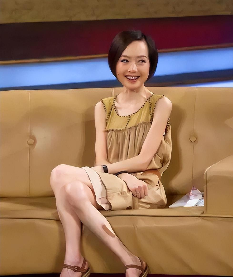 回顾减肥过度是什么样看这几位明星就知道了简直惨不忍睹