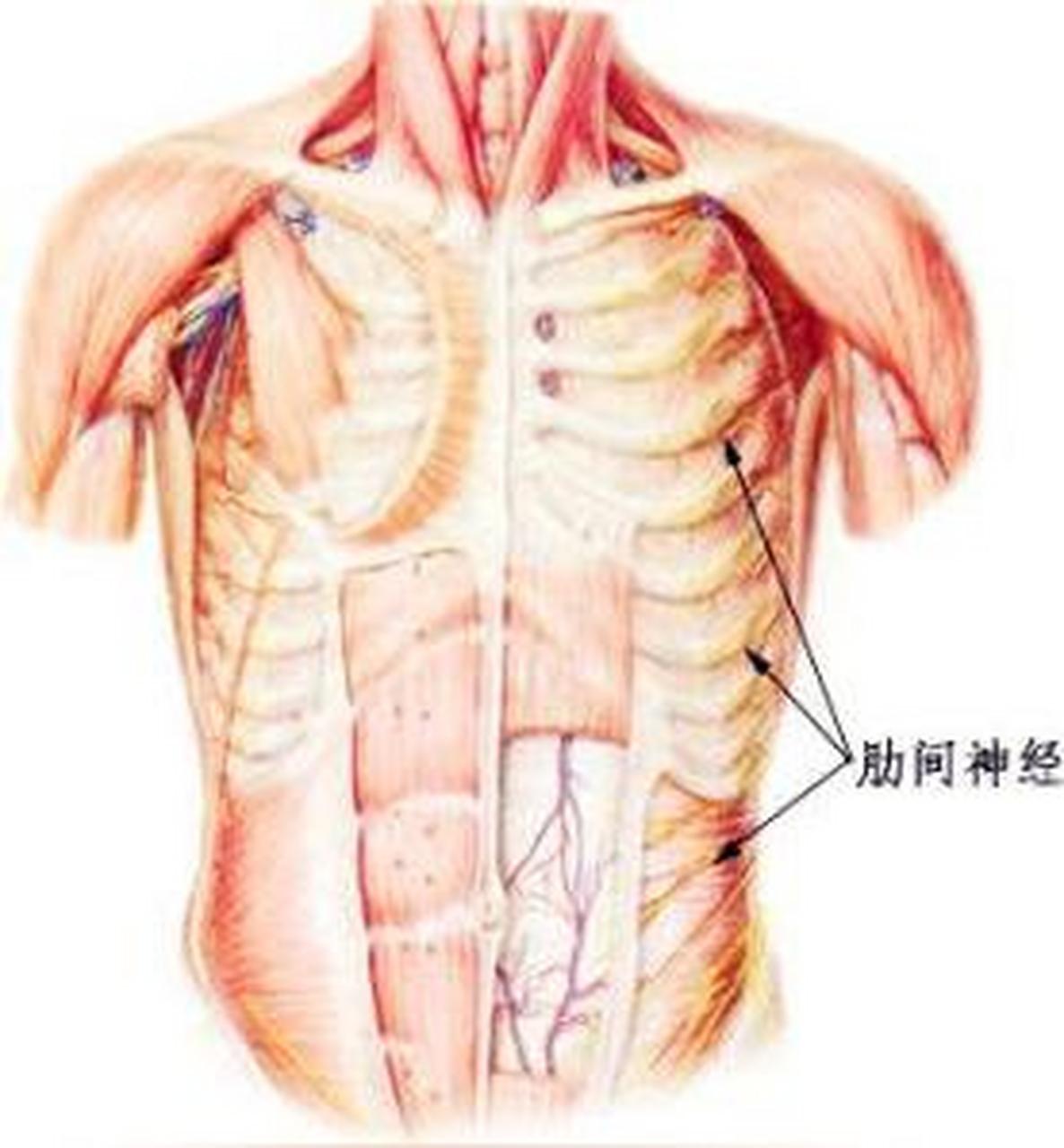 肋间神经炎:了解疼痛背后的神经炎症  肋间神经炎是一种常见的神经