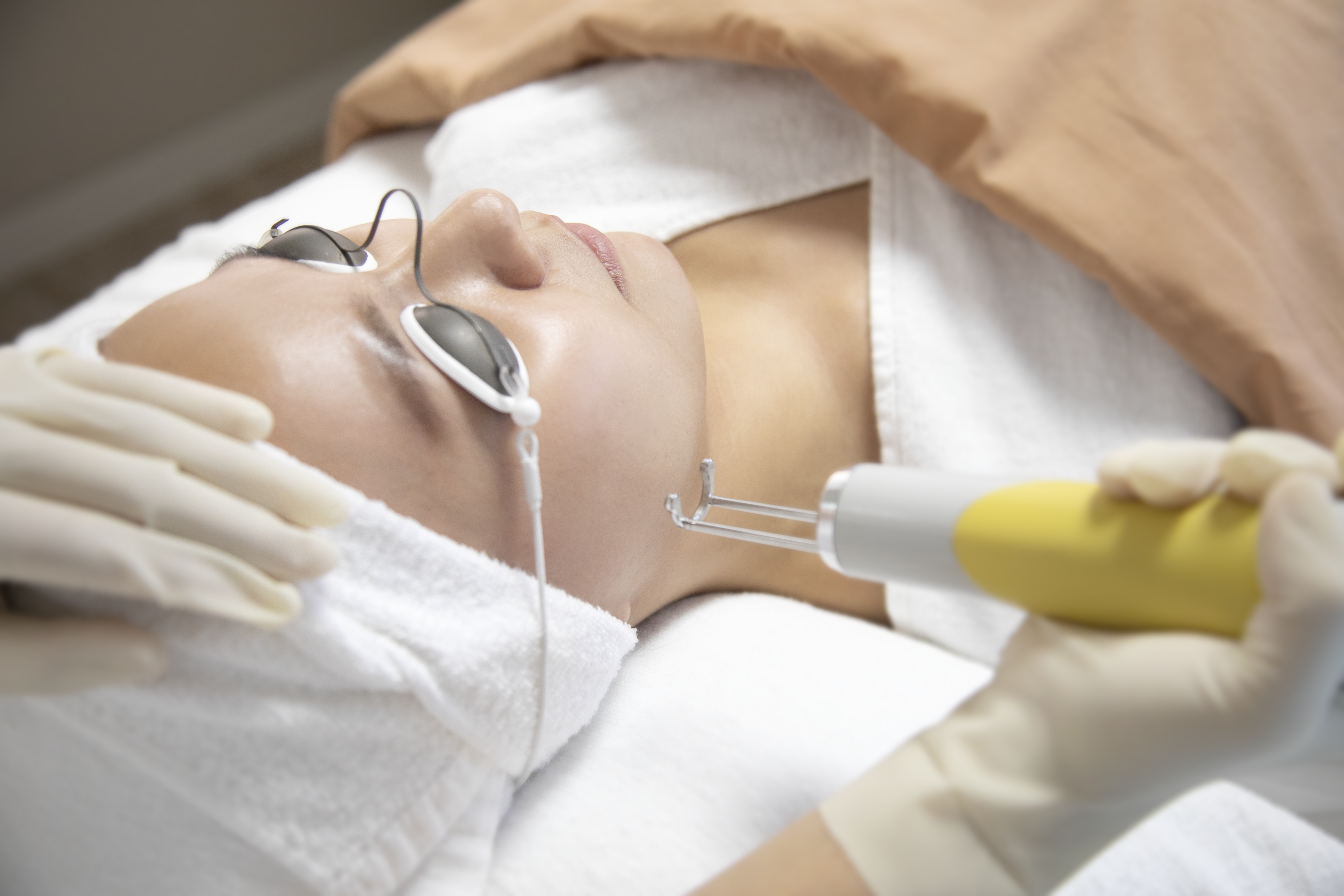 激光嫩肤vs光子嫩肤,哪个抗衰效果更好?快来看看吧