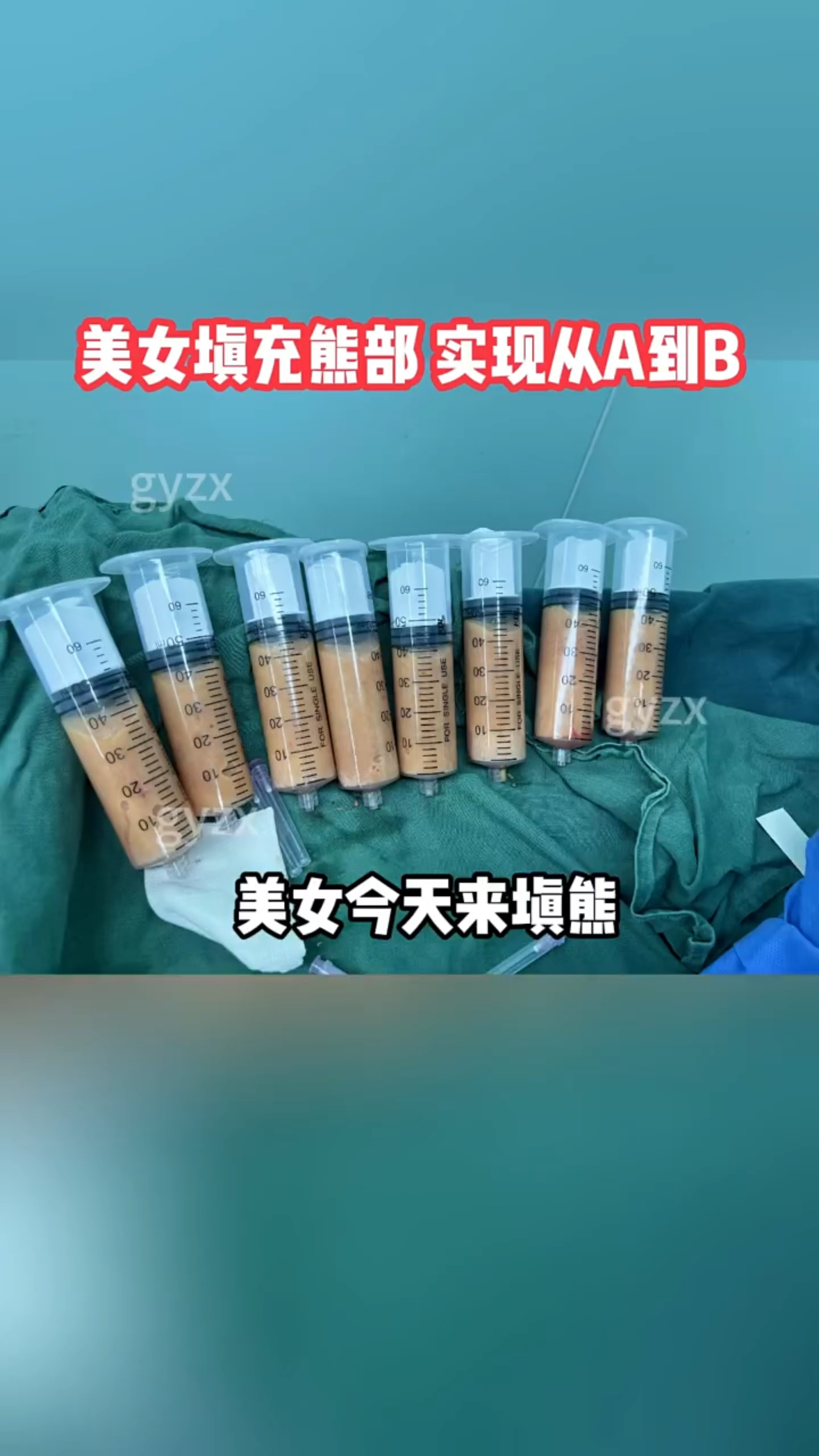 丰胸美女最有效费用图片