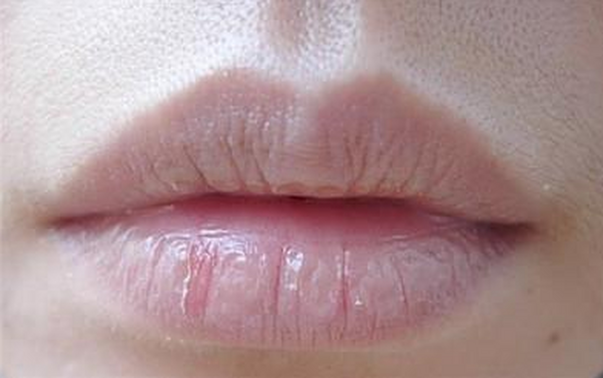 嘴唇干裂和起皮是许多人都会遇到的问题,尤其在干燥的季节