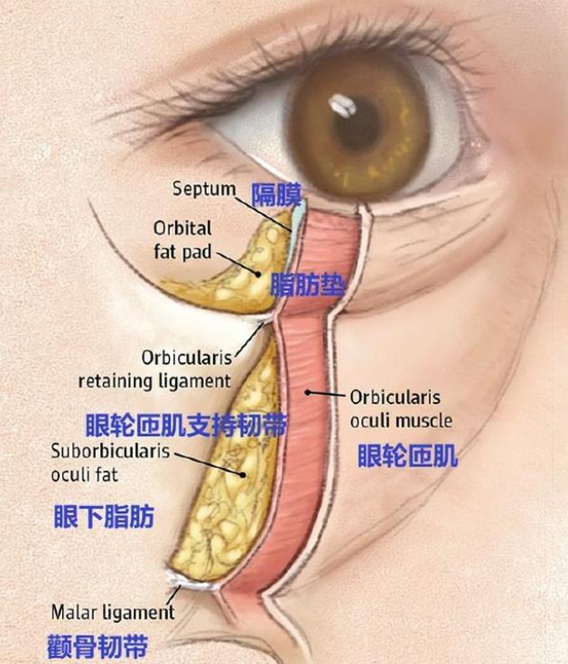 眼轮匝肌去除过多图片图片