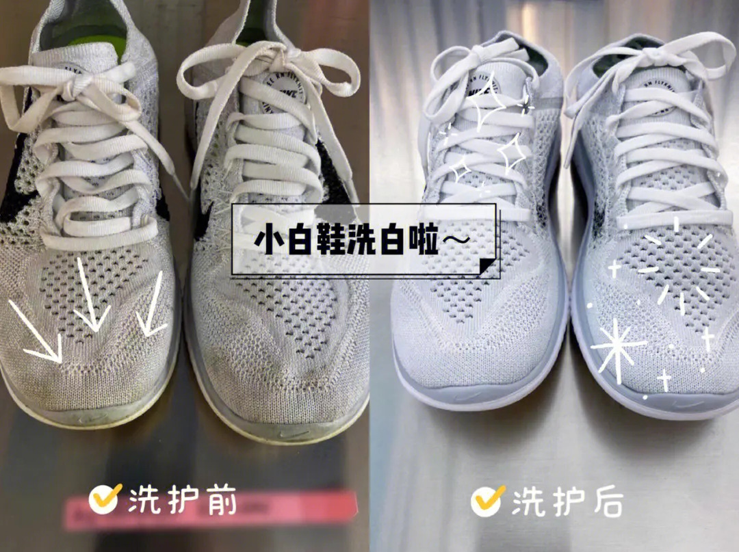 白鞋发黄处理方法:针对不同原因,采取不同措施