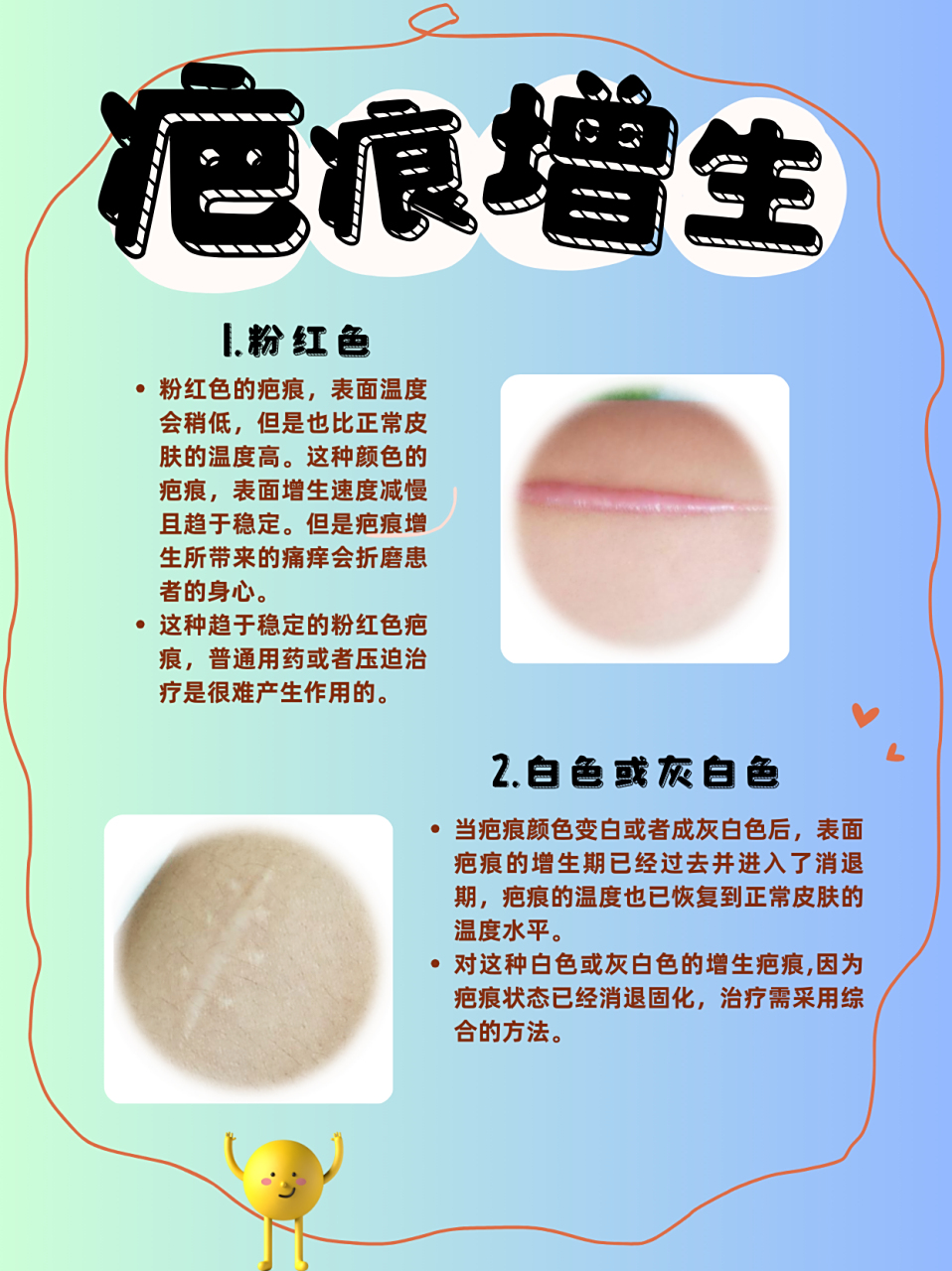 30秒学会通过疤痕颜色判断增生程度  疤痕颜色变化是判断疤痕增生程度