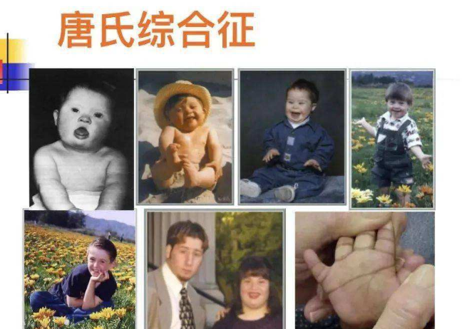 83岁老太毒杀46岁智力缺陷的儿子2017年被捕时称我养不动了