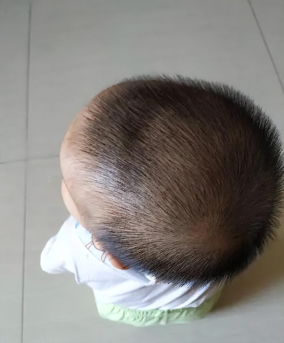 回顾英国大学生头疼就诊经过检查后医生发现他居然没有大脑