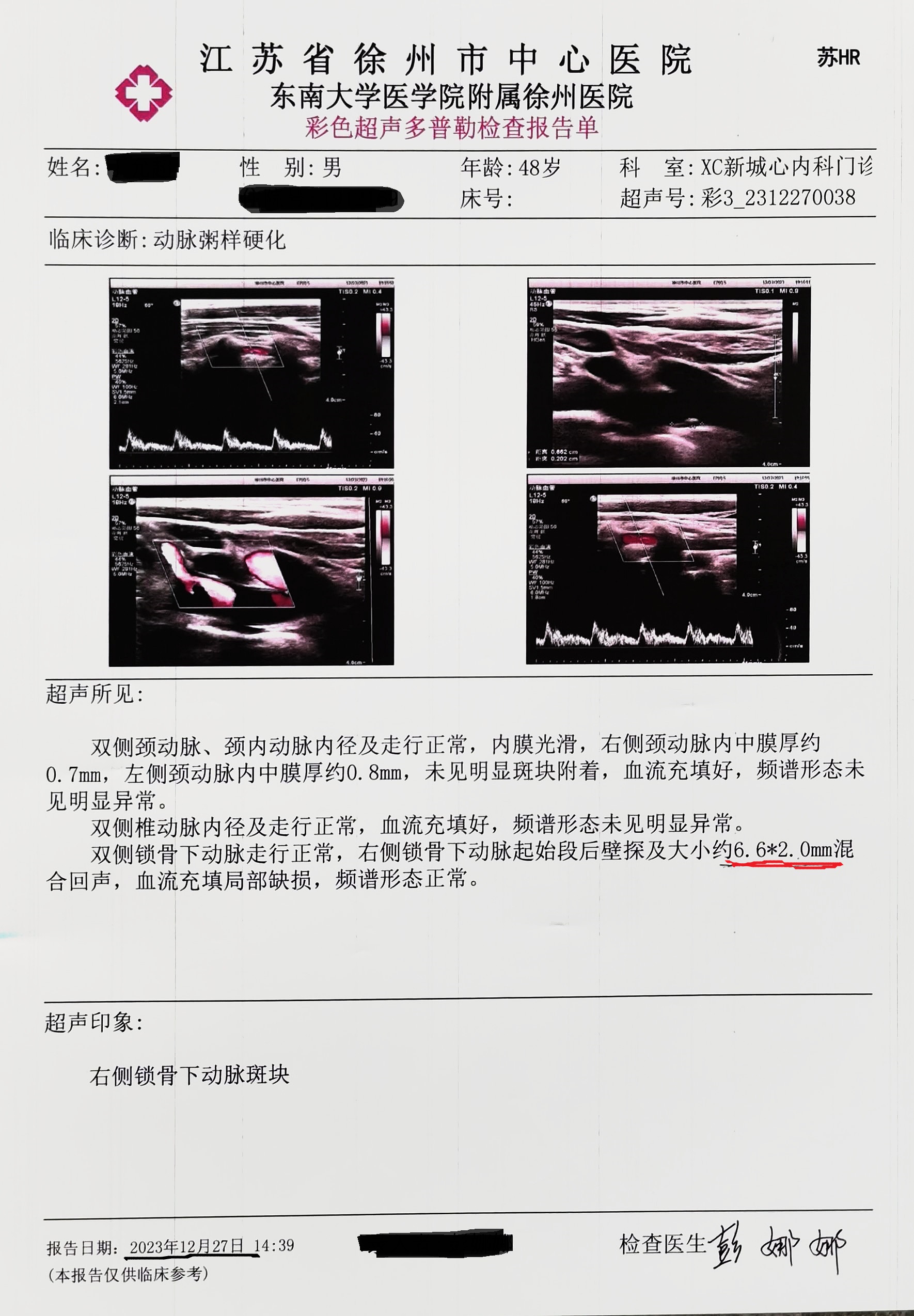 0的斑块,缩小到了1.6.