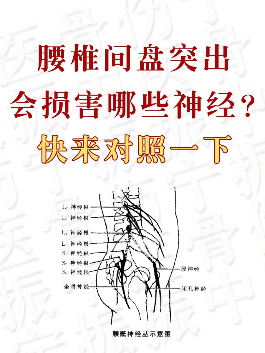 快来对照一下  腰椎间盘突出症