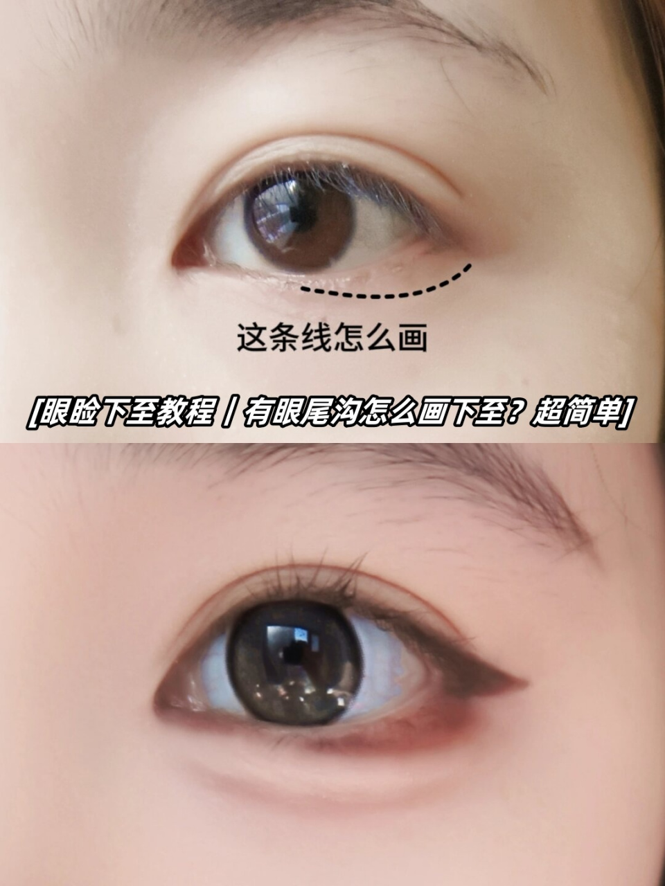 超简单  99眼睑下至教程来啦!