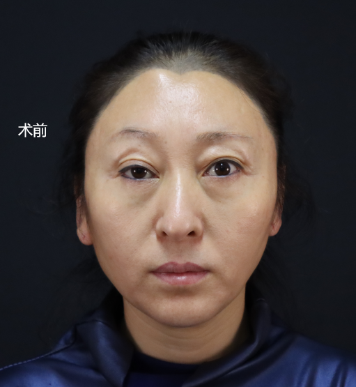 为什么拍照大小眼很明显为什么在线 为什么拍照大小眼很明显为什么在线