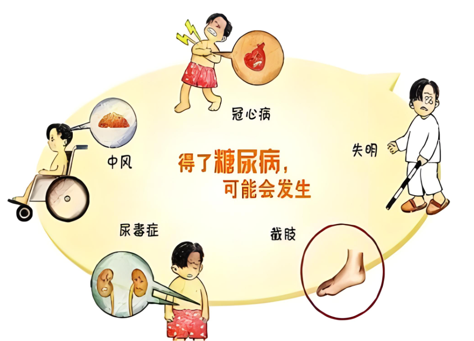 糖尿病足与季节变化如何应对