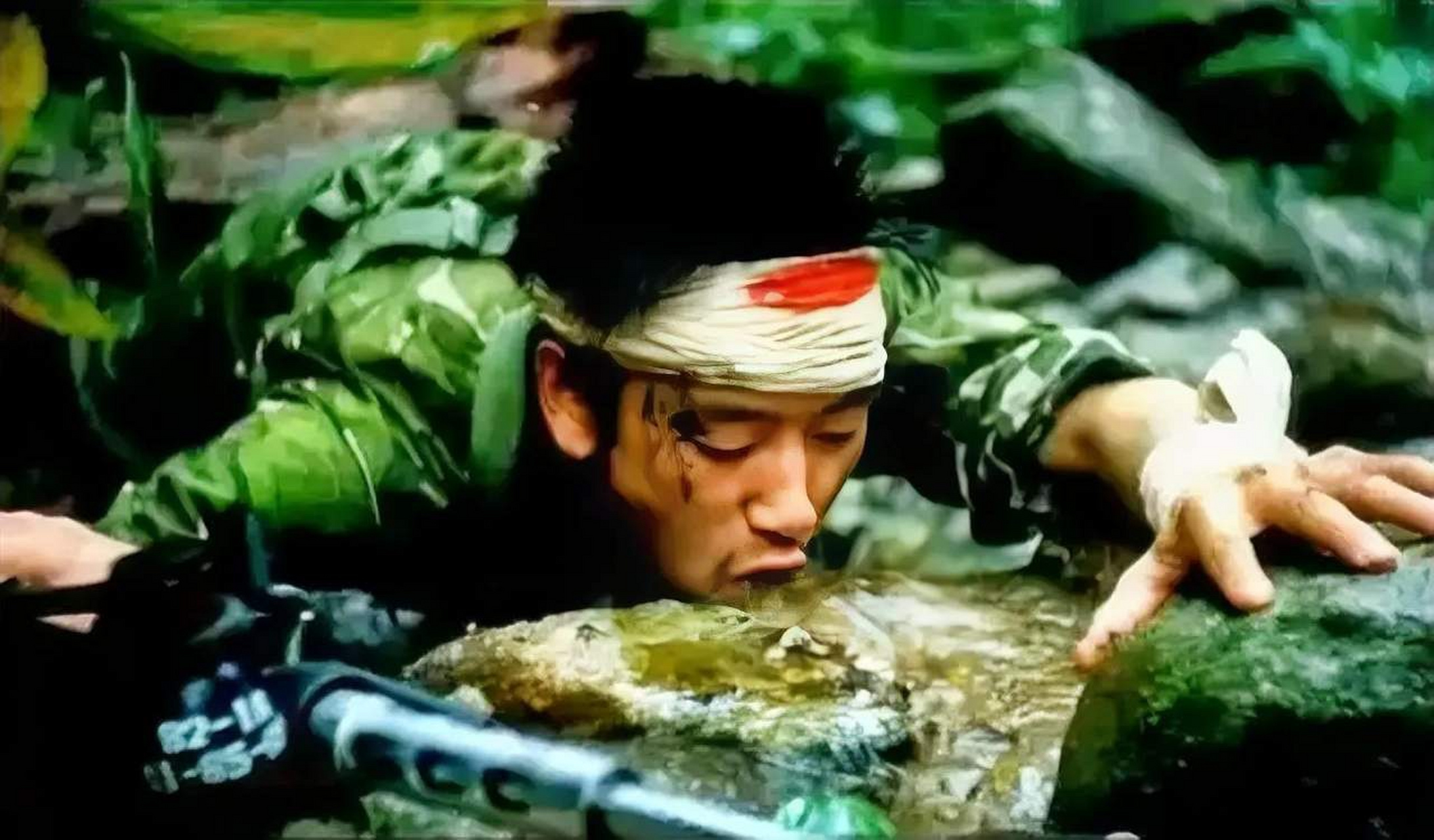 80年代,对越自卫反击战中,被地雷炸伤的战士.