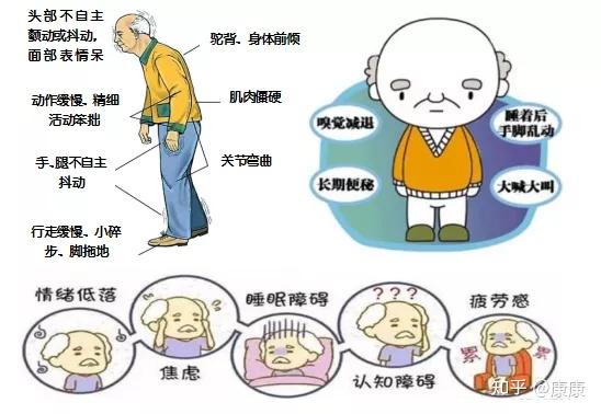 特发性震颤与帕金森病有何不同
