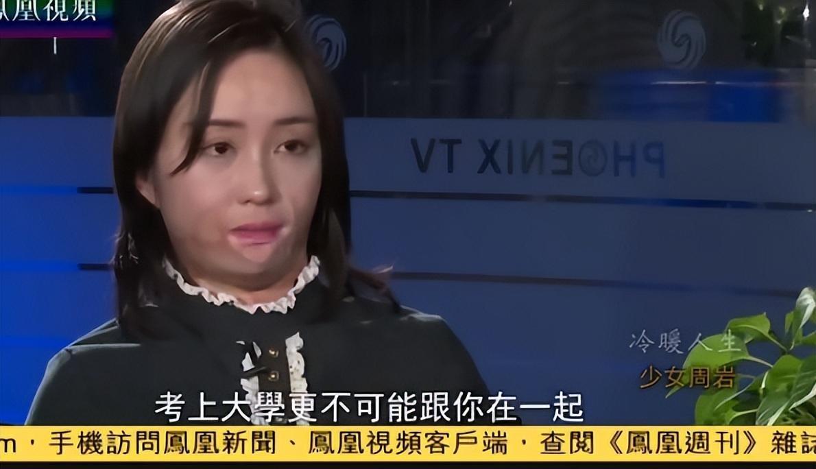回顾毁容女孩周岩十多次整容手术重塑容貌如今收获美好人生