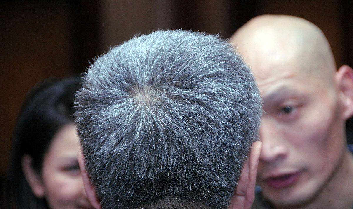 白发长在哪,病就在哪出?长在前额,两鬓,后脑勺,分别说明什么