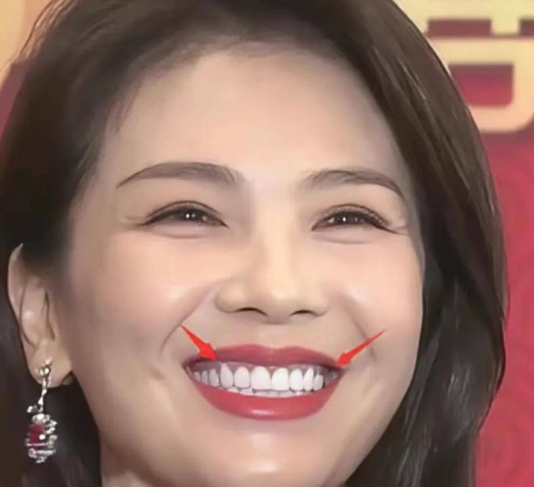 回顾年龄都是假的假发假牙假学历这些明星身上有啥是真的