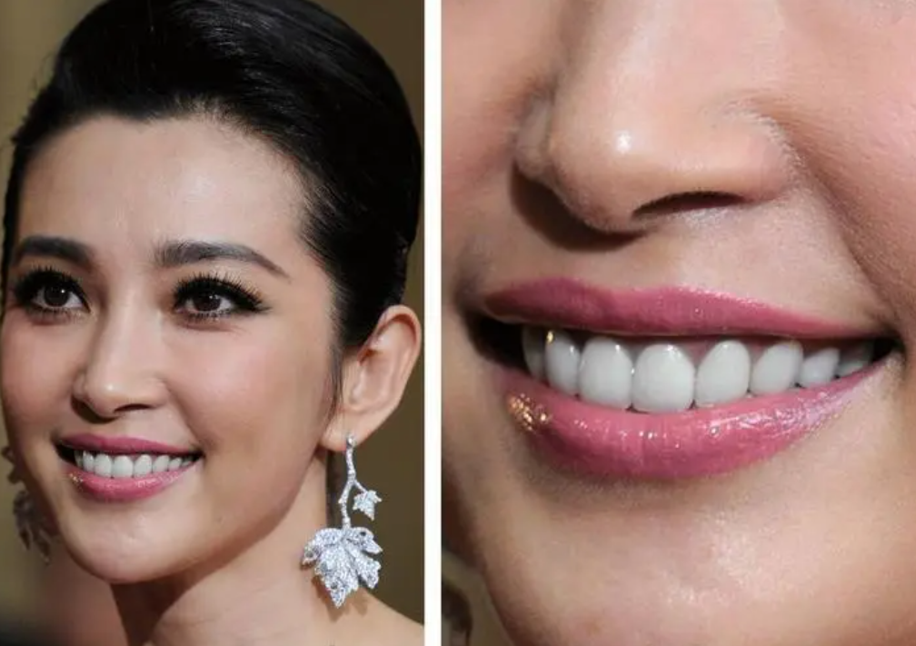 回顾年龄都是假的假发假牙假学历这些明星身上有啥是真的