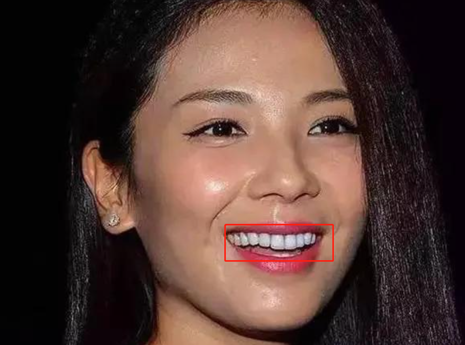回顾年龄都是假的假发假牙假学历这些明星身上有啥是真的