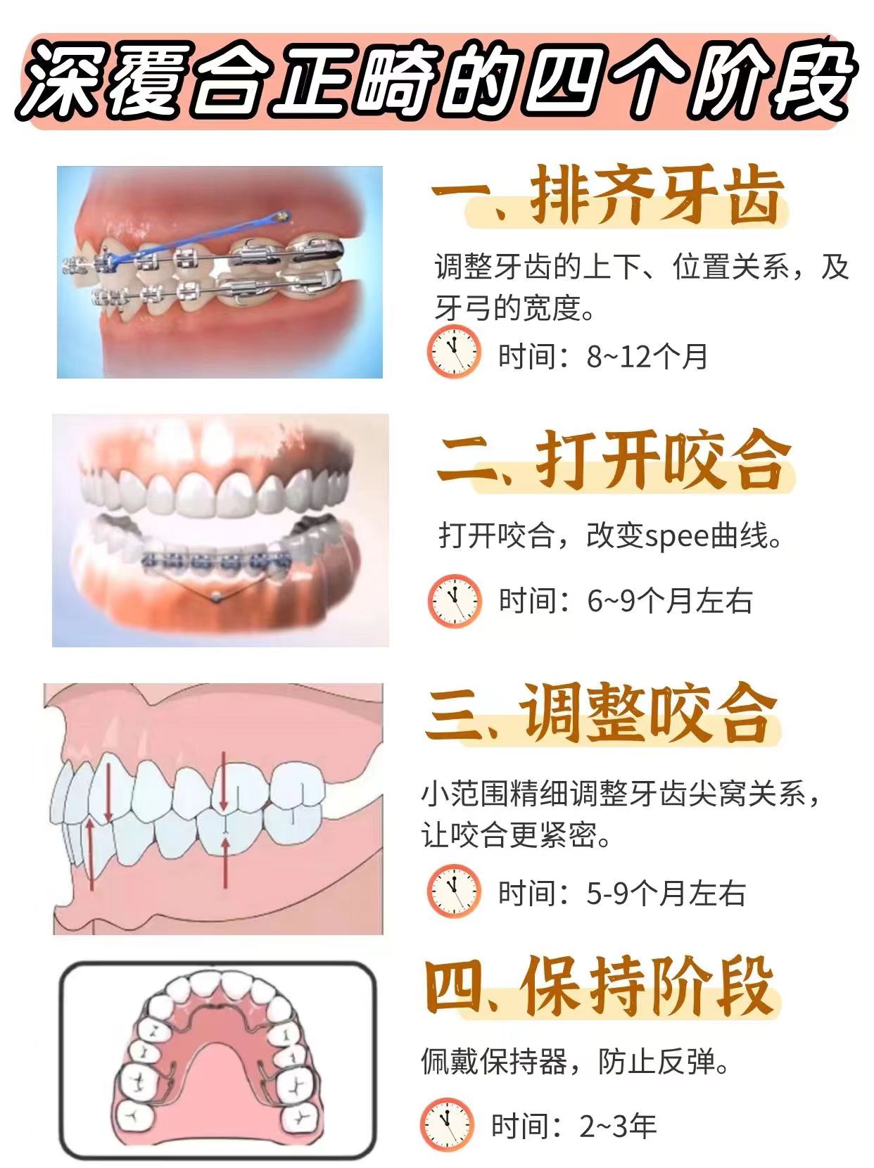 深覆合自我矫正方法图片