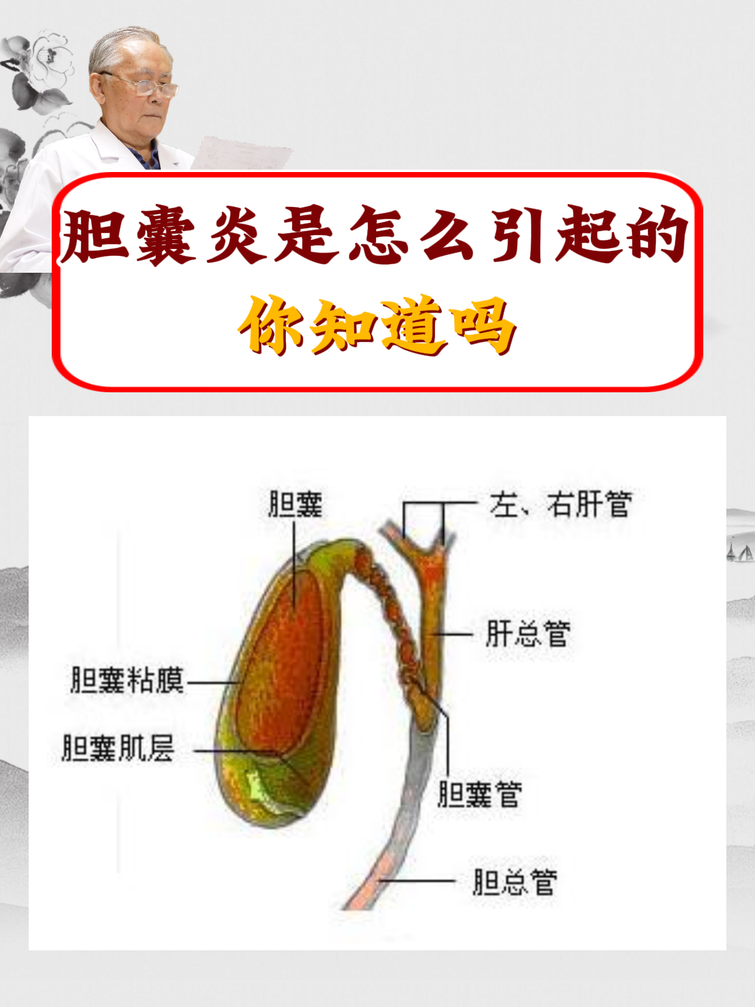 胆囊炎是怎么引起的