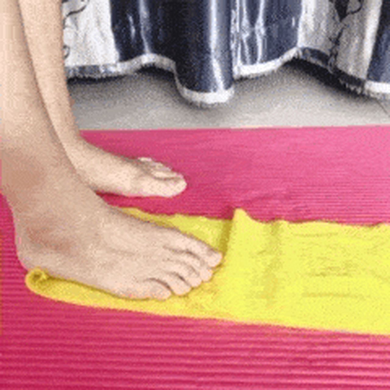 横弓塌陷会导致拇外翻,即大脚骨. 拇外翻是指拇指在第一跖趾关节处向