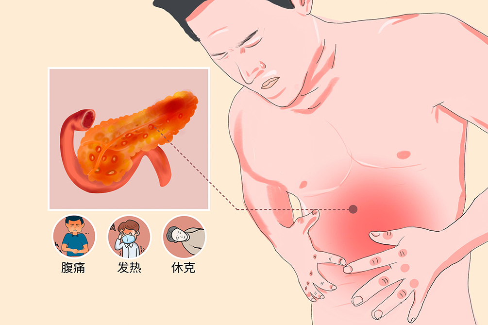 急性胰腺炎卡通图图片