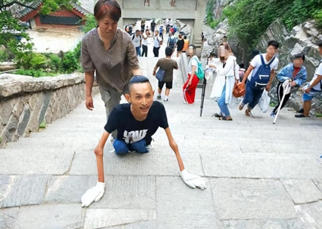 回顾张为16岁患渐冻症28岁登泰山30岁娶老婆后来怎样了