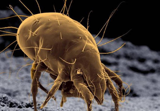 原来螨虫最大"天敌"不是暴晒:房间中放个它,螨虫"跑光光了"