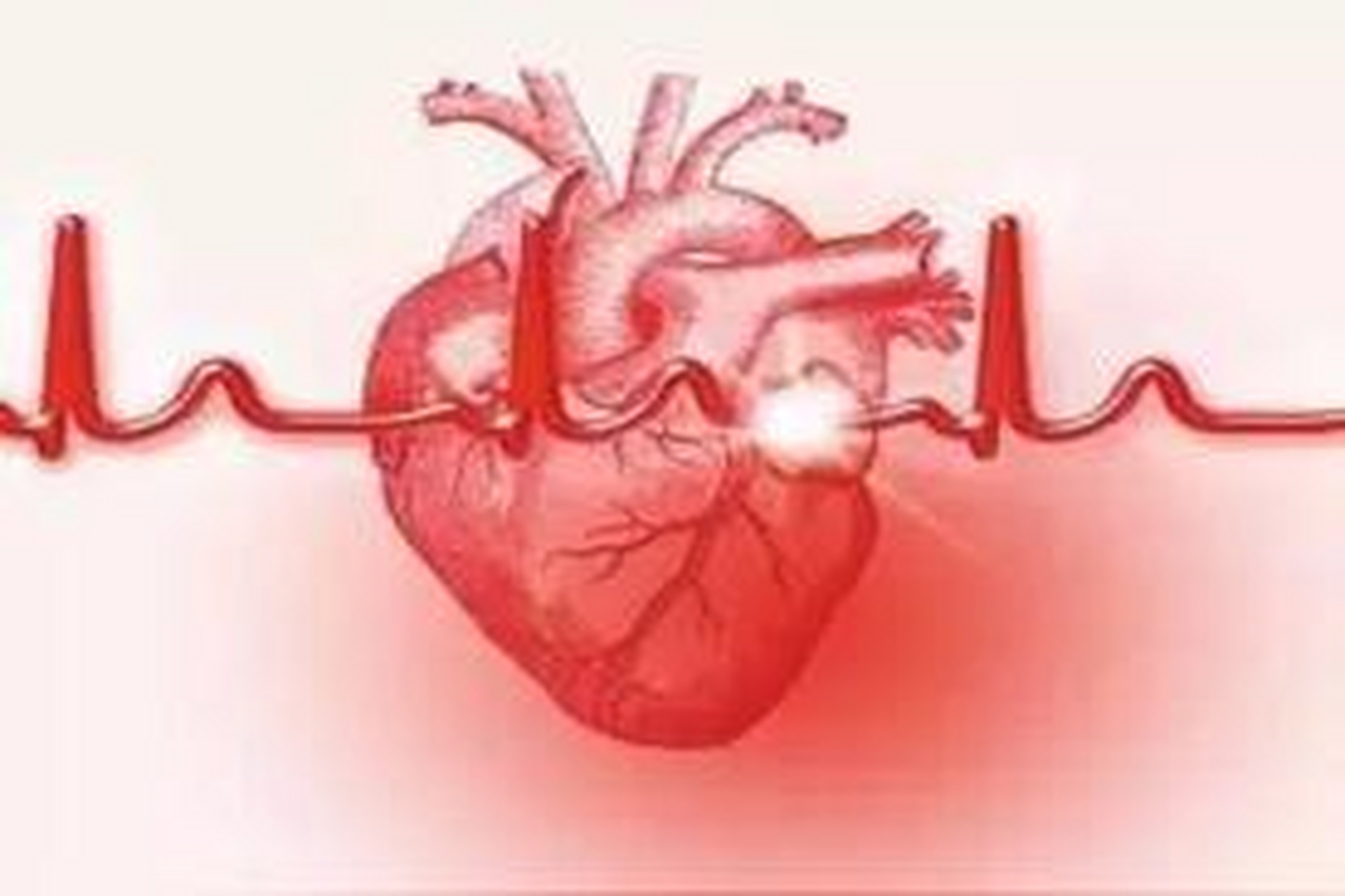 有种"感冒"可能是暴发性心肌炎,要当心!