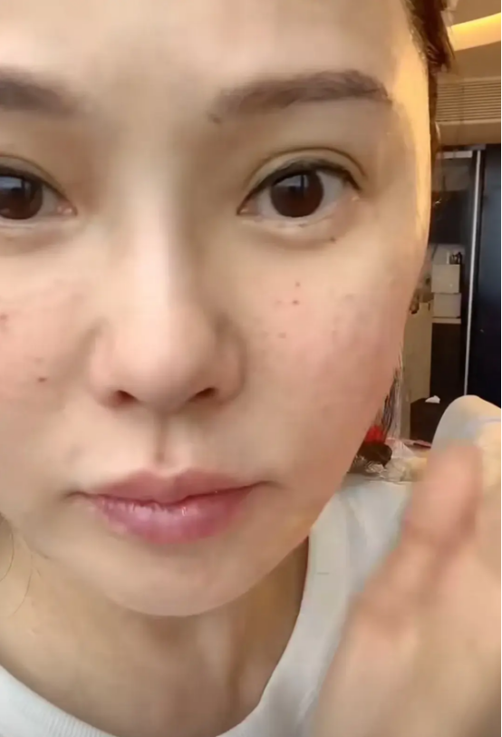 秦昊老婆跑韩国打水光针56岁伊能静满脸针眼感慨真的很痛