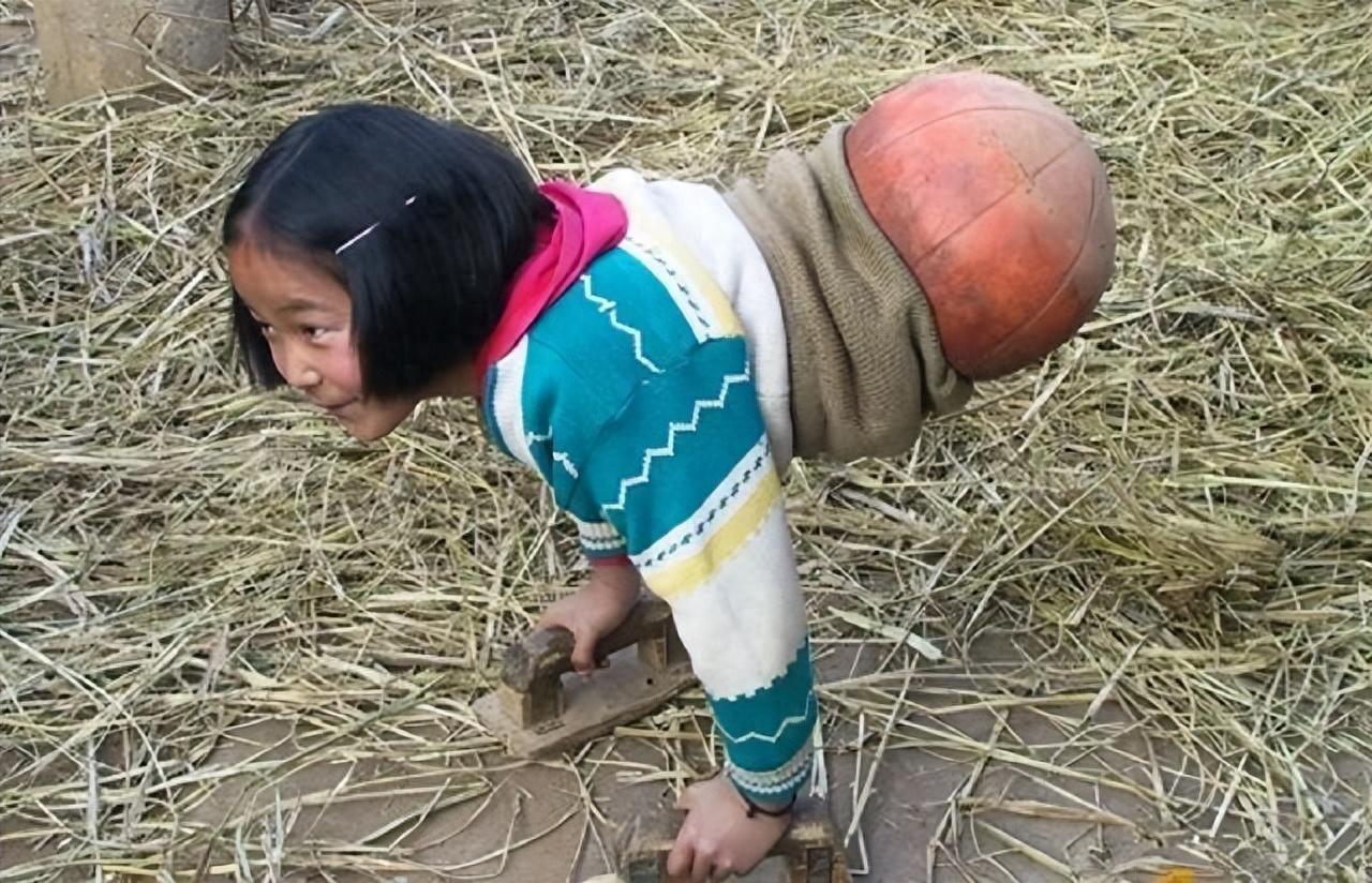 回顾央视曾报道的篮球女孩4岁车祸失去双腿20多年过去今如何