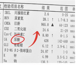 肾功能检查表怎么看 1,肌酐.