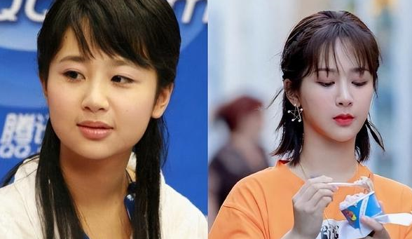 明明从大饼脸变小v脸,却死不承认整容?醒醒吧,已经被基因出售