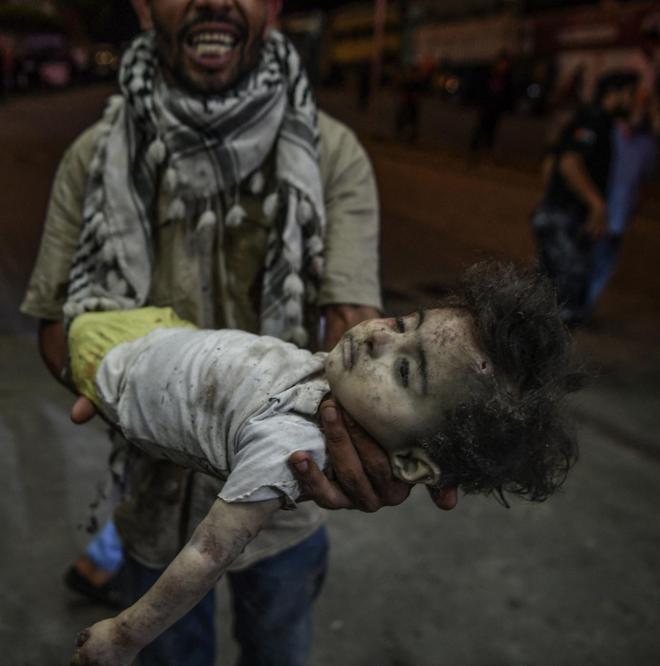 巴以冲突,儿童妇女都无法幸免,加沙上演种族灭亡,人道主义何在