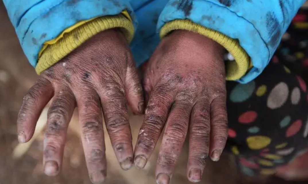 他和奶奶以及姐姐住在一起,奶奶年纪大了,所以他和姐姐都分外早熟,也